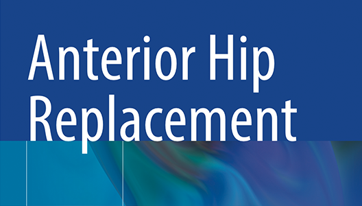 Anterior Hip Replacement- from Origins to Current Advanced Techniques, published 2022