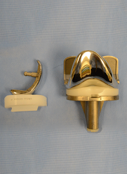 Partial and Total Knee Implant