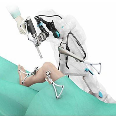 Robotic Arm Technology
